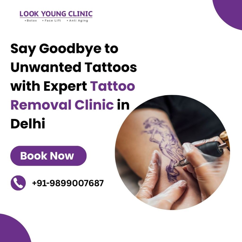 Tattoo Removal in Delhi